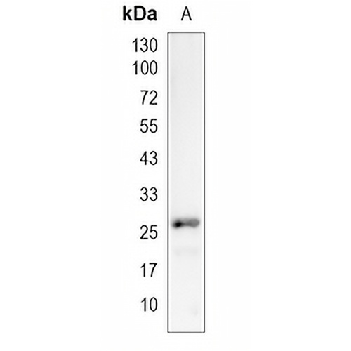 SYPL1 Rabbit Monoclonal Antibody(C1996)