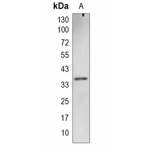 DBX2 Rabbit Monoclonal Antibody(C1997)