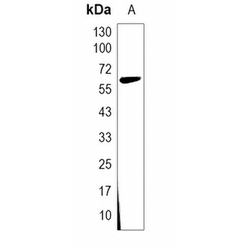 GMEB1 Rabbit Monoclonal Antibody(C1998)
