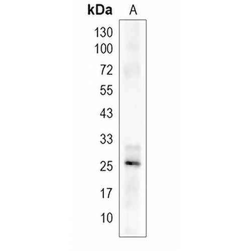 TSPAN4 Rabbit Monoclonal Antibody(C2001)
