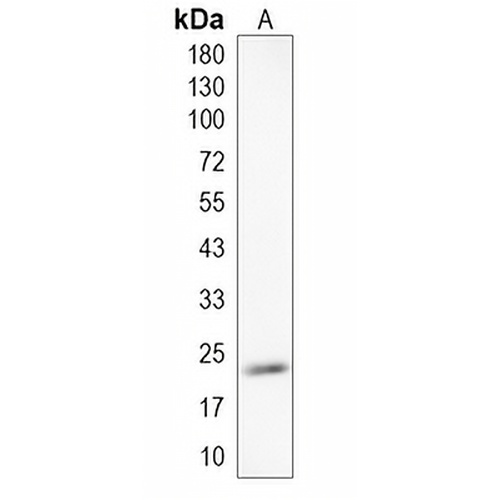 RAB7B Rabbit Monoclonal Antibody(C2003)