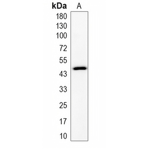 PDSS1 Rabbit Monoclonal Antibody(C2004)