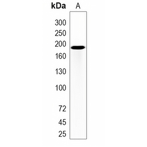 TIAM2 Rabbit Monoclonal Antibody(C2005)