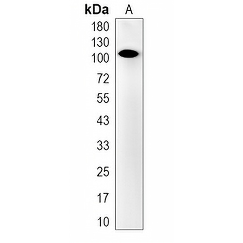 OSBPL1A Rabbit Monoclonal Antibody(C2006)