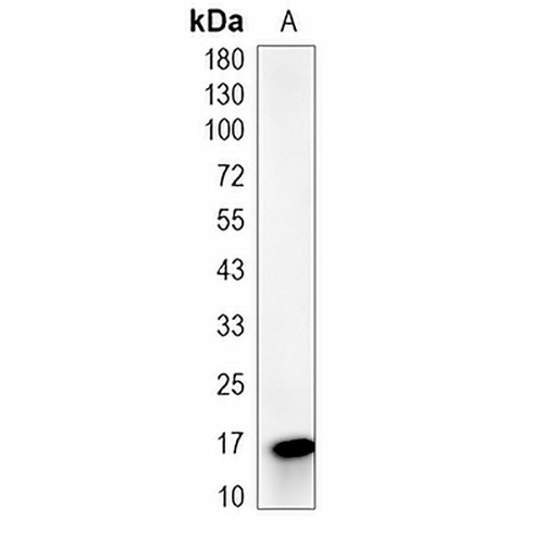CLEC2B Rabbit Monoclonal Antibody(C2007)