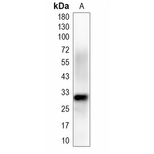 SLBP Rabbit Monoclonal Antibody(C2008)