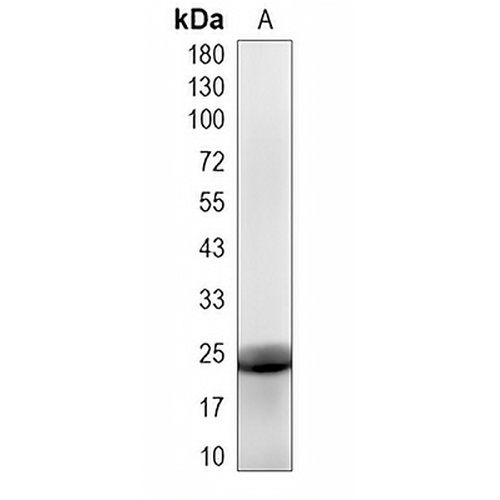 STARD4 Rabbit Monoclonal Antibody(C2011)