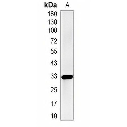 DOHH Rabbit Monoclonal Antibody(C2012)