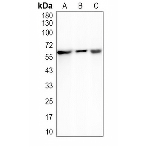 Occludin Rabbit Monoclonal Antibody(C2015)
