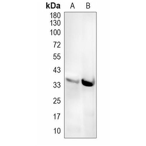Arginase 1 Rabbit Monoclonal Antibody(C2016)