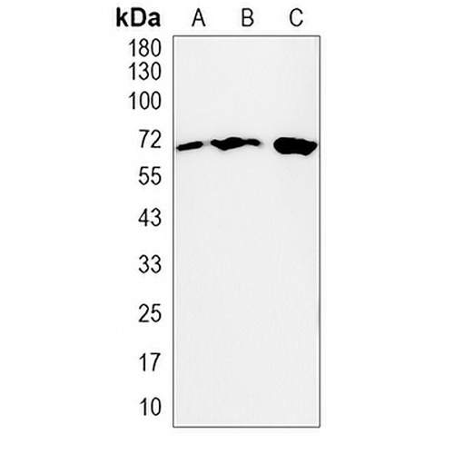 YTHDF1 Rabbit Monoclonal Antibody(C2017)