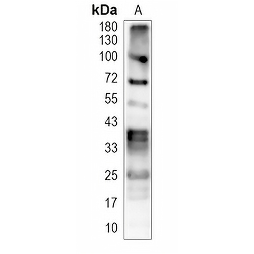 Phospho-Serine/Threonine Rabbit Monoclonal Antibody(C2018)