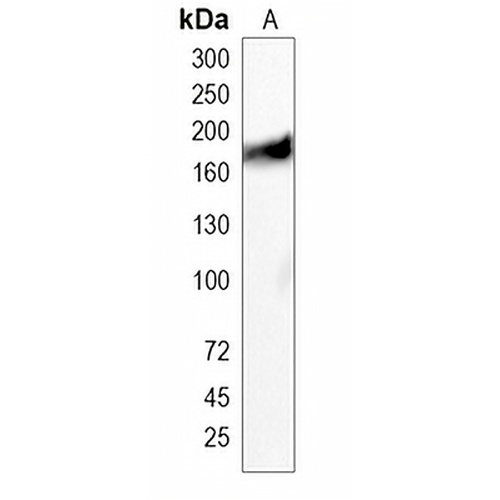 Thrombospondin 1 Rabbit Monoclonal Antibody(C2019)