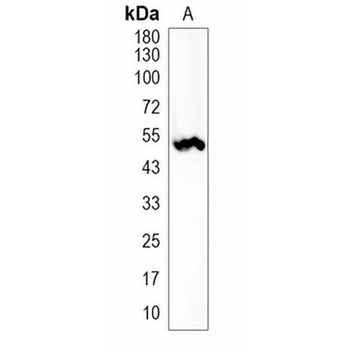 Cytokeratin 14 Rabbit Monoclonal Antibody(C2022)