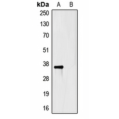 HSV-tag Mouse Monoclonal Antibody(C2030)