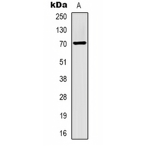 Alpha-fetoglobulin Mouse Monoclonal Antibody(C2076)