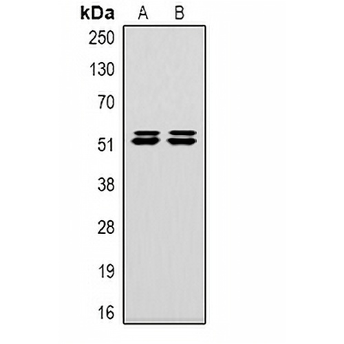 Carbonic Anhydrase 9 Mouse Monoclonal Antibody(C2102)