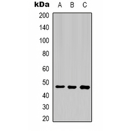 Cytokeratin 17 Mouse Monoclonal Antibody(C2116)