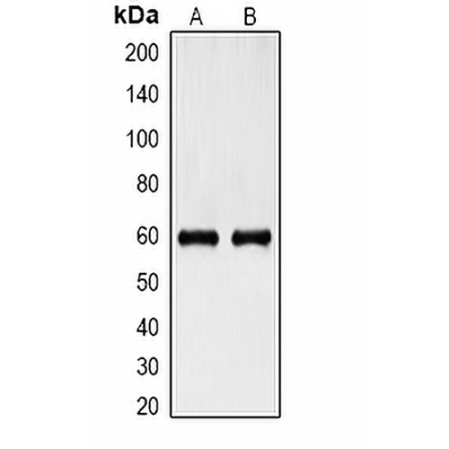Cytokeratin 6 Mouse Monoclonal Antibody(C2120)