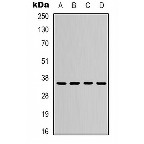 ERCC1 Mouse Monoclonal Antibody(C2127)