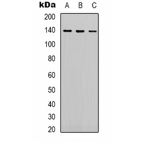 HER2 Mouse Monoclonal Antibody(C2140)