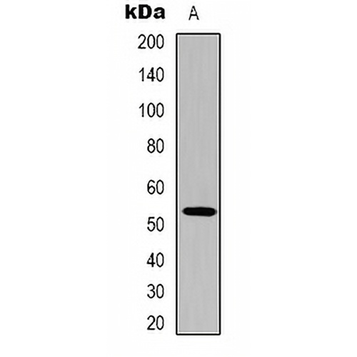 p53 Mouse Monoclonal Antibody(C2172)