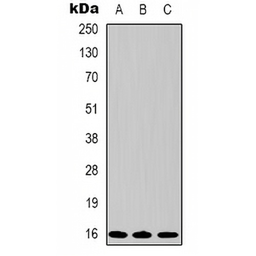 Survivin Mouse Monoclonal Antibody(C2184)