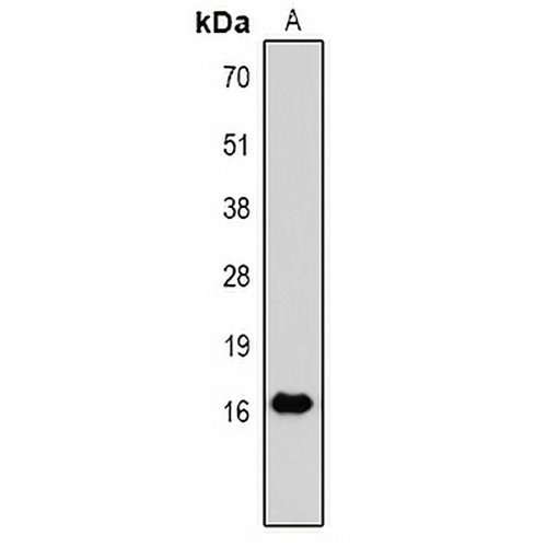 TNF alpha Mouse Monoclonal Antibody(C2186)