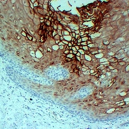Annexin A1 Mouse Monoclonal Antibody(C2191)