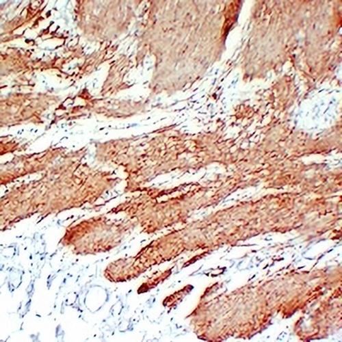 Calponin 1 Mouse Monoclonal Antibody(C2193)