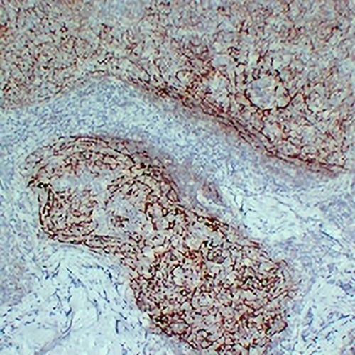 CD21 Mouse Monoclonal Antibody(C2194)