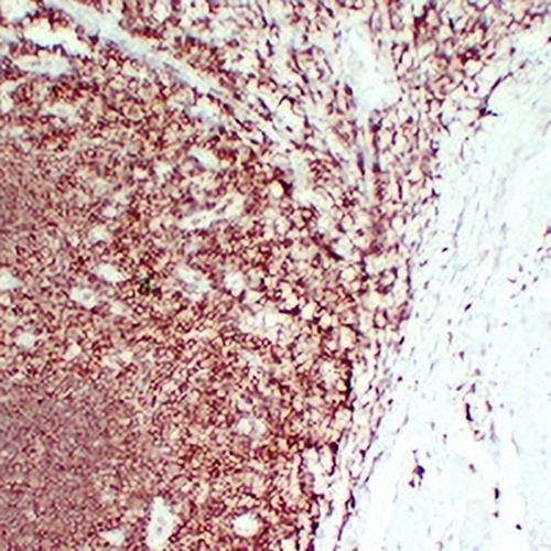 CD45 Mouse Monoclonal Antibody(C2197)
