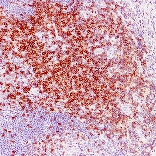 CD5 Mouse Monoclonal Antibody(C2198)