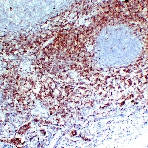 CD7 Mouse Monoclonal Antibody(C2200)