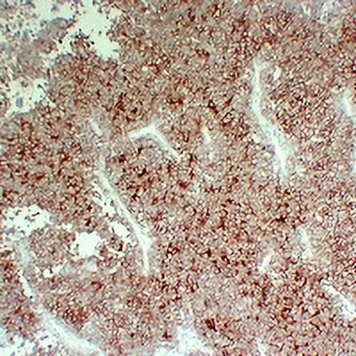 CD99 Mouse Monoclonal Antibody(C2201)