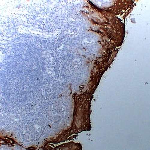 CD66e Mouse Monoclonal Antibody(C2202)