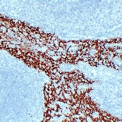 Cytokeratin 14 Mouse Monoclonal Antibody(C2203)