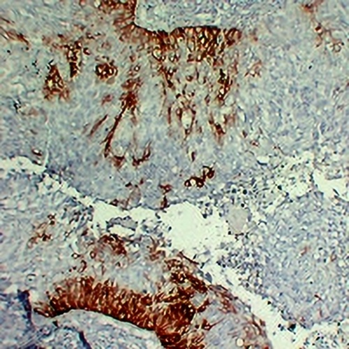 Cytokeratin 15 Mouse Monoclonal Antibody(C2204)