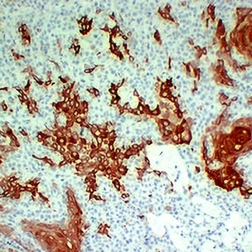 Cytokeratin 16 Mouse Monoclonal Antibody(C2205)