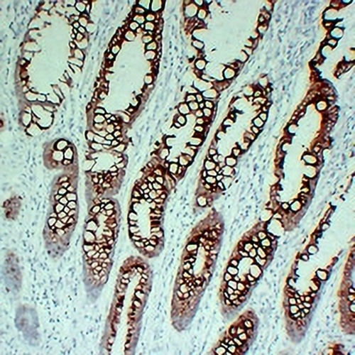 Cytokeratin 20 Mouse Monoclonal Antibody(C2206)