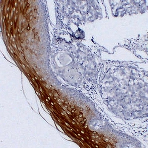 Cytokeratin 4 Mouse Monoclonal Antibody(C2207)