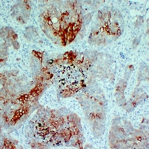 Cytokeratin 5/6 Mouse Monoclonal Antibody(C2208)