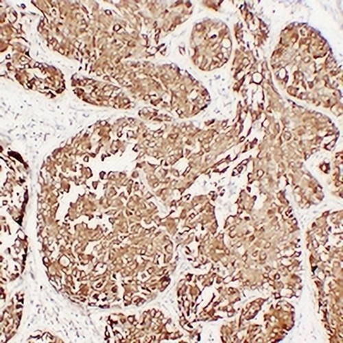 MUC1 Mouse Monoclonal Antibody(C2209)