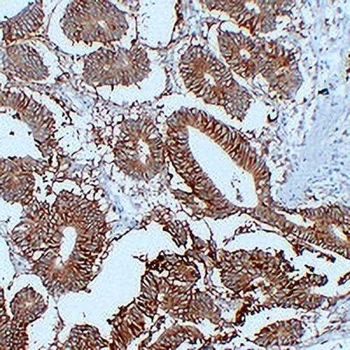 CD326 Mouse Monoclonal Antibody(C2210)