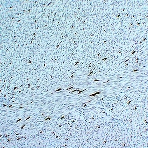 Factor XIIIa Mouse Monoclonal Antibody(C2211)