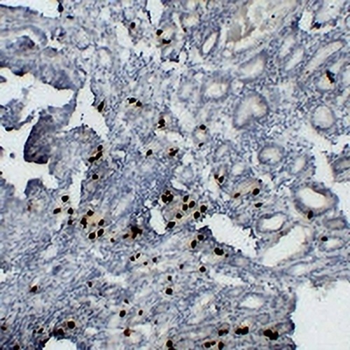 Gastrin Mouse Monoclonal Antibody(C2213)