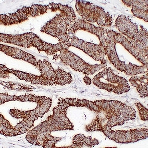 HSP60 Mouse Monoclonal Antibody(C2217)