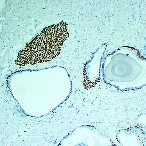 p63 Mouse Monoclonal Antibody(C2218)