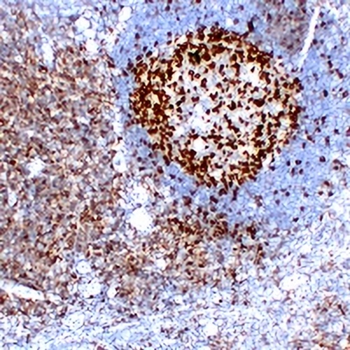 CD279 Mouse Monoclonal Antibody(C2219)