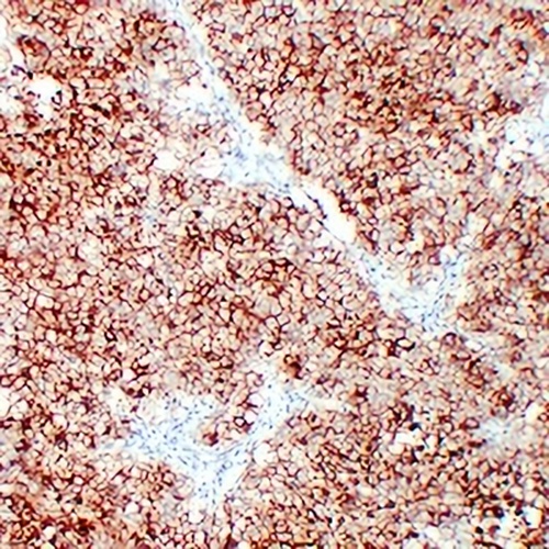 ALPP Mouse Monoclonal Antibody(C2220)